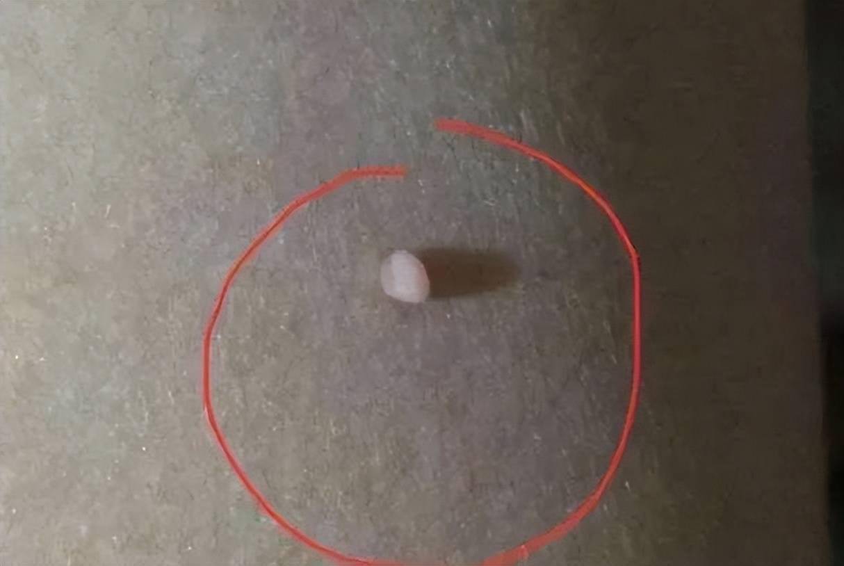 脖子和腋下的小肉粒是什么能直接用手揪掉吗看完要牢记