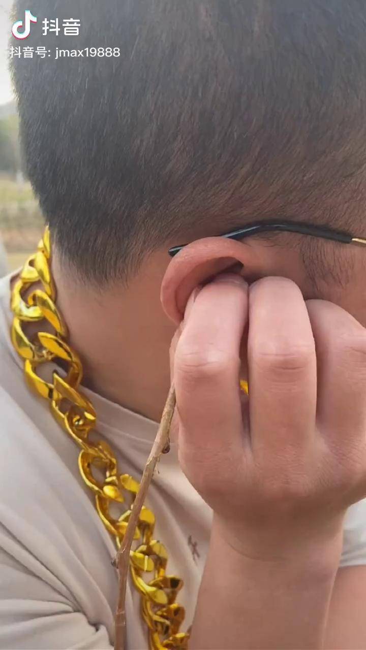 这下耳朵尖多了内容太过真实段子原创搞笑搞笑荆门爆笑阿鑫爆笑阿鑫