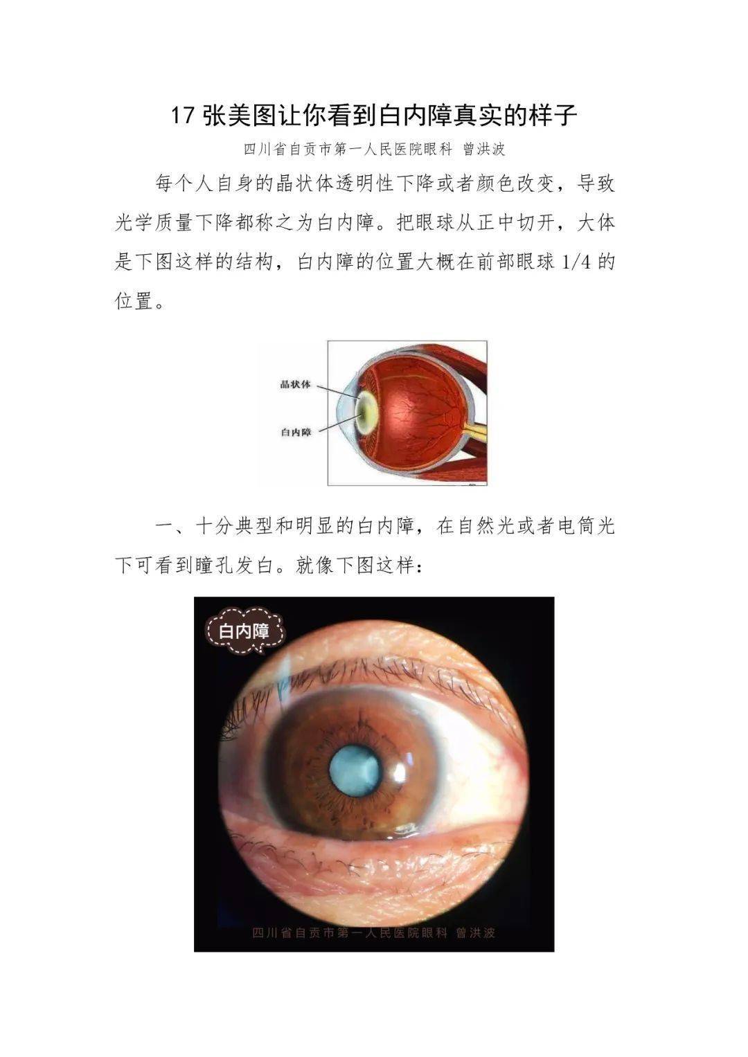 17张美图让你看到白内障真实的样子!_眼镜_企业_作业