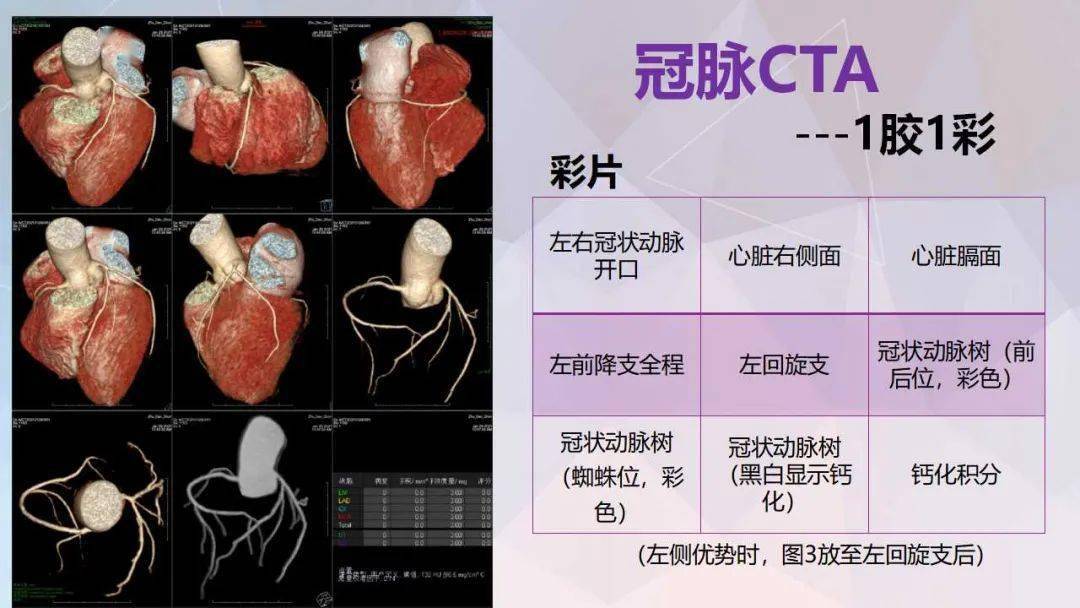 冠脉及胸痛三联cta重建规范及报告模板