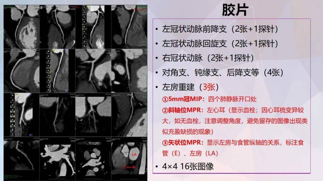 冠脉及胸痛三联cta重建规范及报告模板