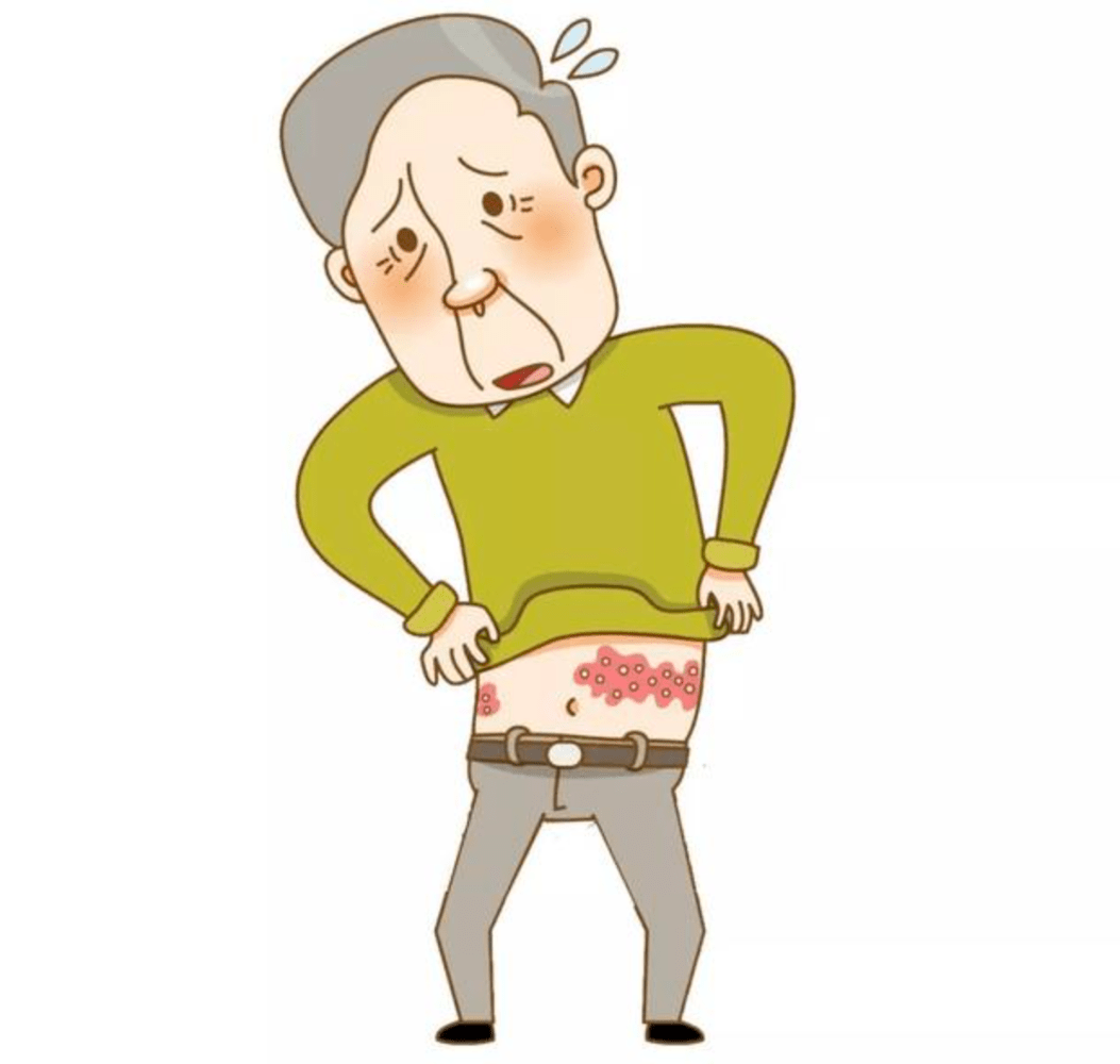 专家谈病带状疱疹上热搜市中研附院皮肤科专家带你认识缠人的带状疱疹