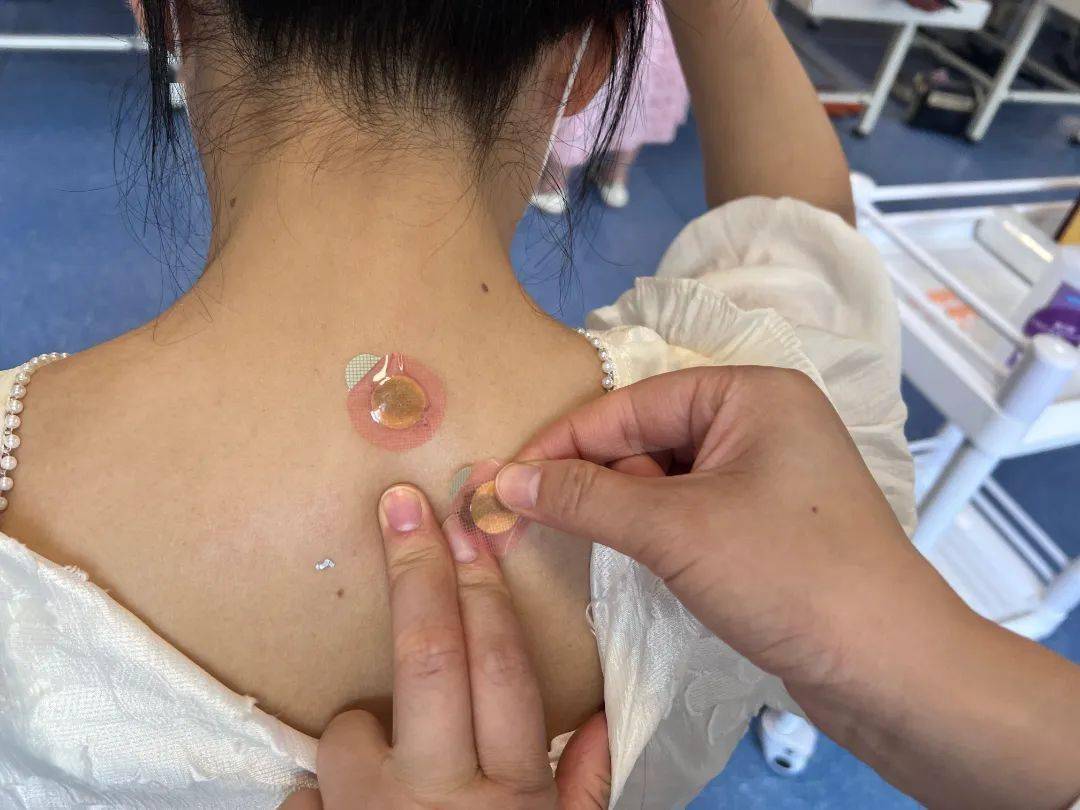 "康达医院的三伏灸三伏贴效果真好"!_疾病_治疗_患者