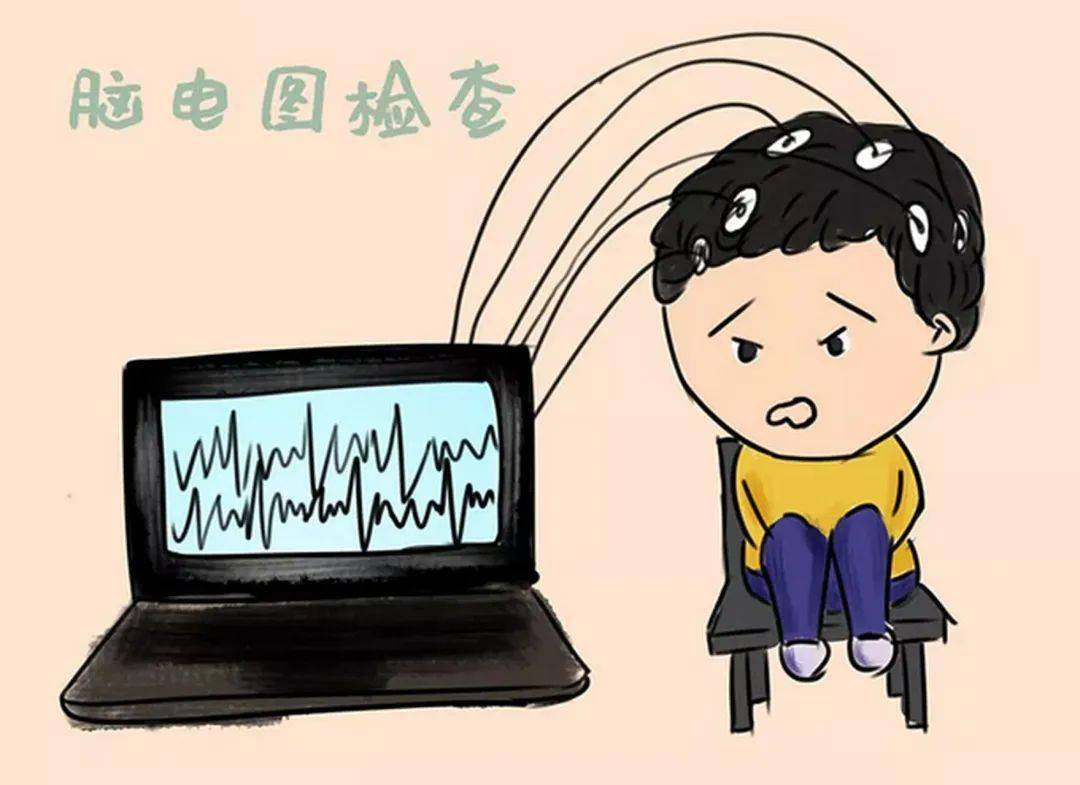 腦電圖(eeg),是神經系統最常用的輔助檢查方法之一.