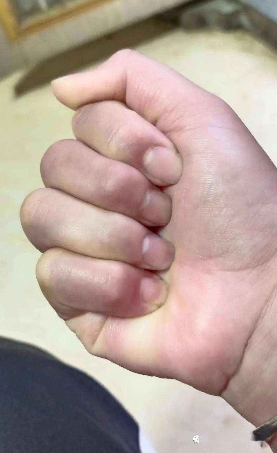 集急诊,医疗,康复,科研,教学为一体的二级骨科医院,断肢,断指再植