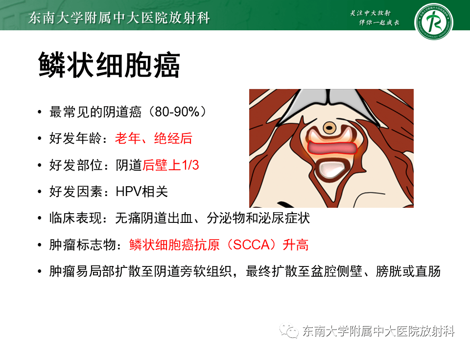 女性尿道生殖膈區佔位性病變的影像診斷