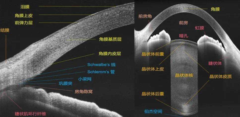 光学相干断层扫描(oct),清晰显示视网膜横断面结构眼底照相及oct的