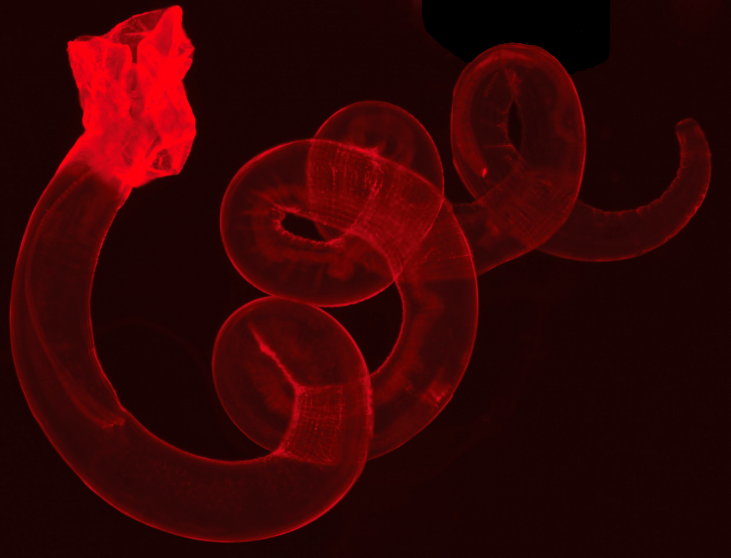 钩虫的几只幼虫轻轻地压到他的前臂上,然后等待这些微小的生物钻进去