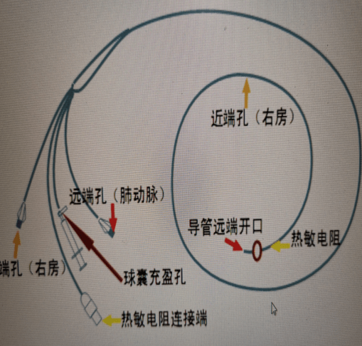 高级血流动力学监测丨血流动力学监测技术_导管_肺动脉_临床