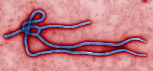 埃博拉吐肠子图片