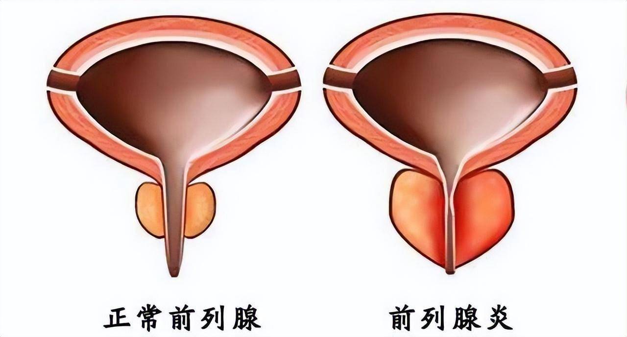 對女性來說子宮是非常重要的器官之一,相對於男性,前列腺則是生殖系統