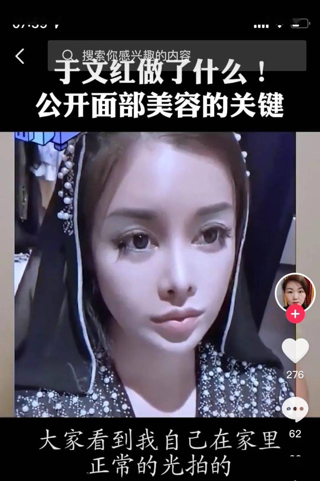 隐匿47亿收入,开在西湖景区别墅,51岁医美女老板收