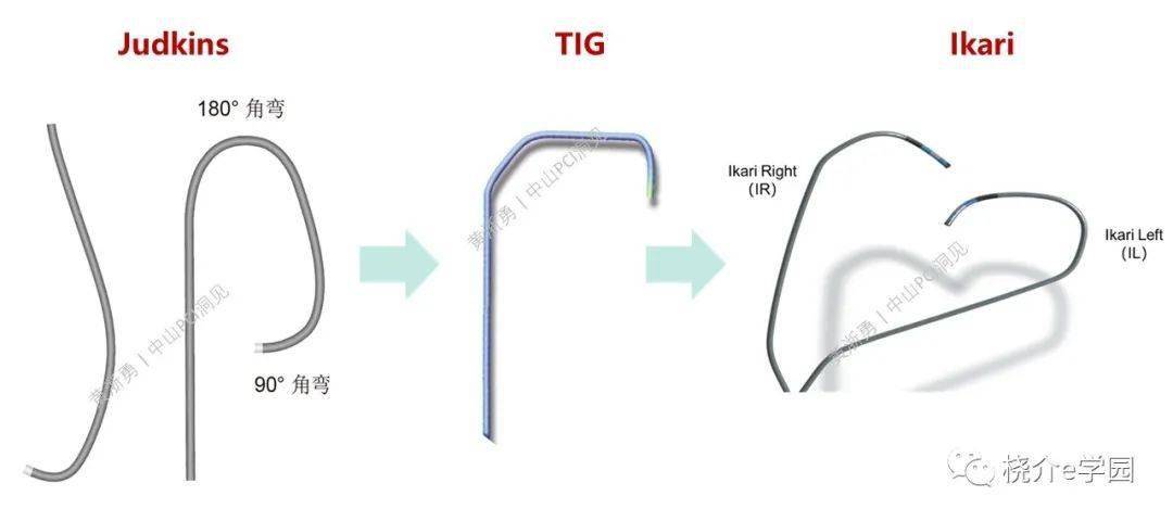 ikari left左右冠共用指引导管,如何操作?_黄浙勇_造影_桡动脉