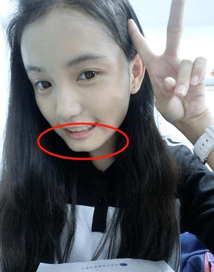 美人沟下巴有多好看?
