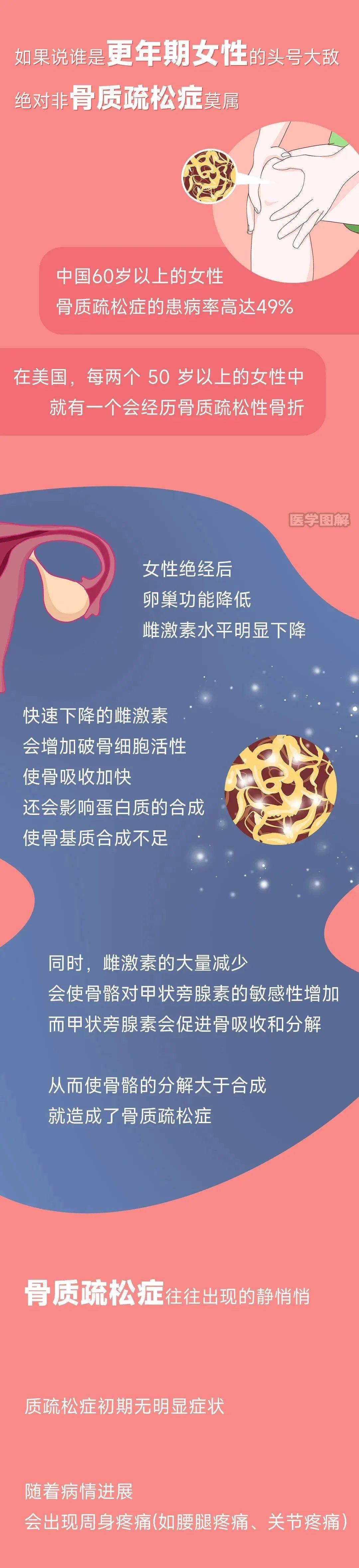 更年期女性的头号大敌 骨质疏松症 如何通过饮食和运动来预防 Cn 钟璋 来源