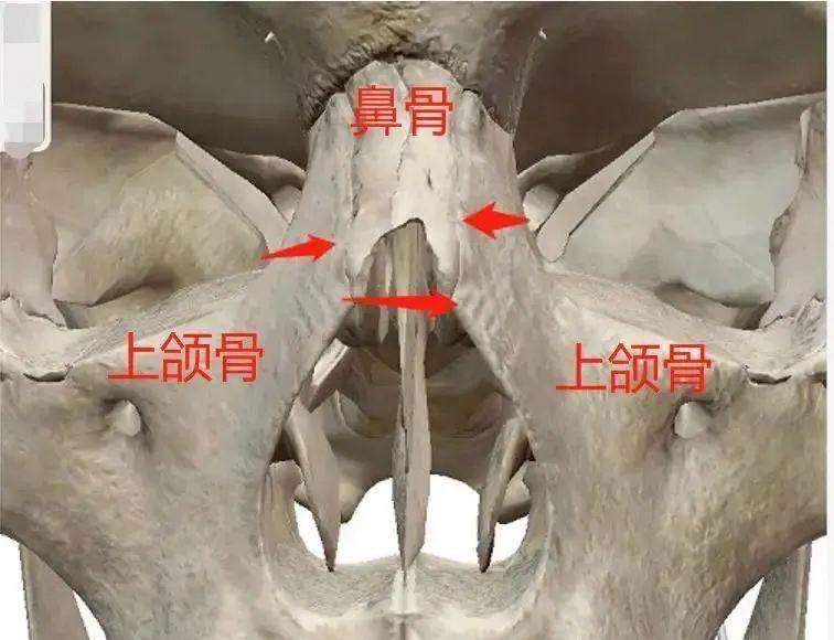 鼻子發育不全,面部的骨骼感已經完全消失;如果上頜骨低而扁平,無法讓