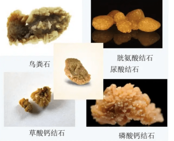 1:结石介绍(一)感染类结石(鸟粪石)一:狗狗泌尿结石