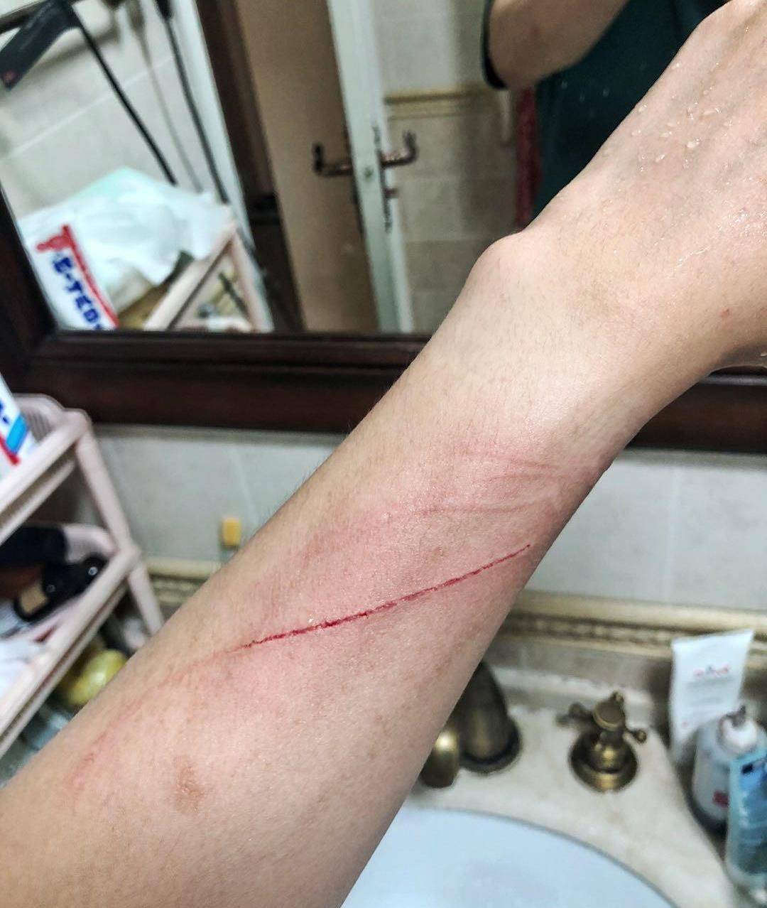 不说了,看着我手上满是抓痕,我的心很累,出去继续战斗.