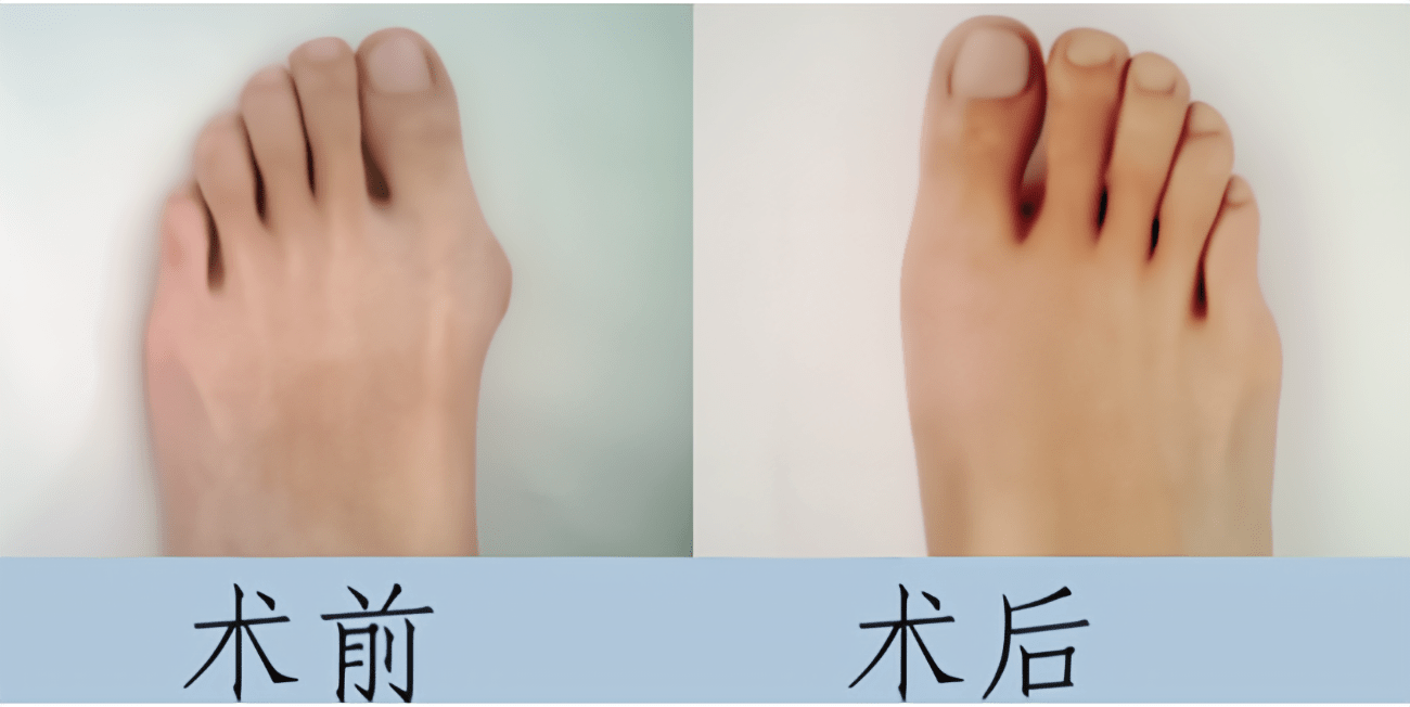 都会买大两码,很多他穿着下地的旧板鞋每一双都会在拇指部位被磨穿