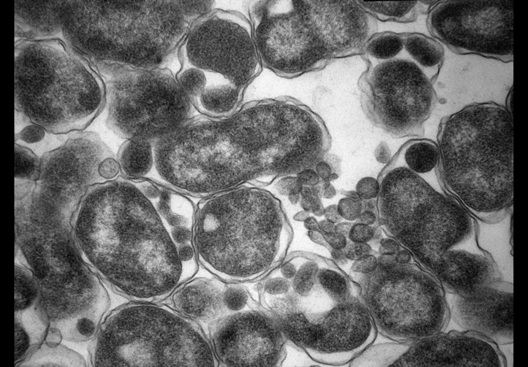 多数欧洲国家和美国,日本以及我国香港等国家和地区,已将鹦鹉热衣原体
