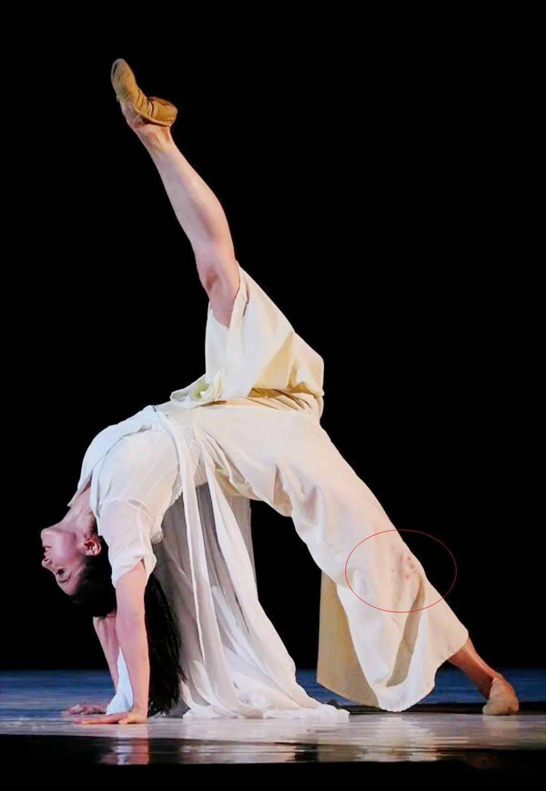 唐诗逸的膝盖伤痕累累~~舞友:所有的伤疤都是她最闪耀的勋章!