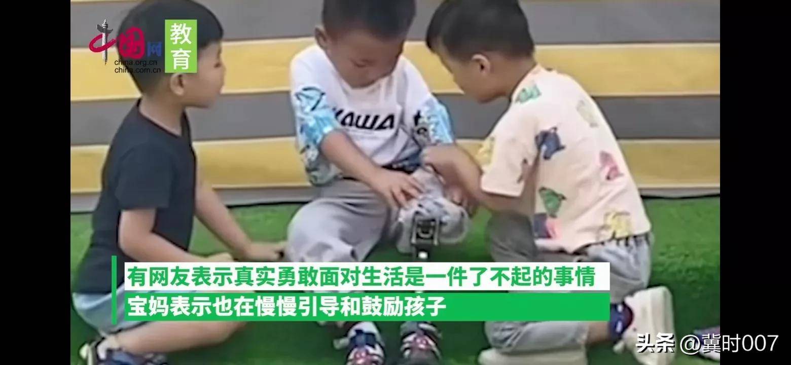 男孩因为车祸失去左腿，在幼儿园坦然展示假肢，妈妈含泪拍下