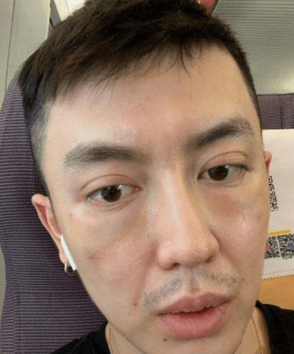 网红金大威表示整容失败史,从鲜肉变大叔,到底是谁"毁"了他?