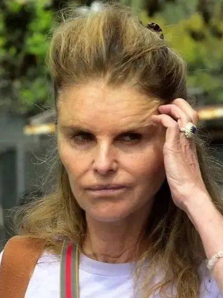 734次整容之后,她失去的不只是美貌_linda_施瓦辛格_玛丽娅·施莱弗