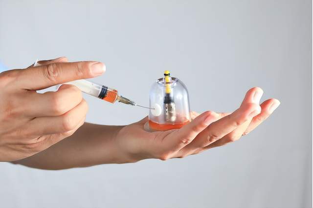 宇泉罐诊罐疗的发明与创新_诊断_人体_疾病