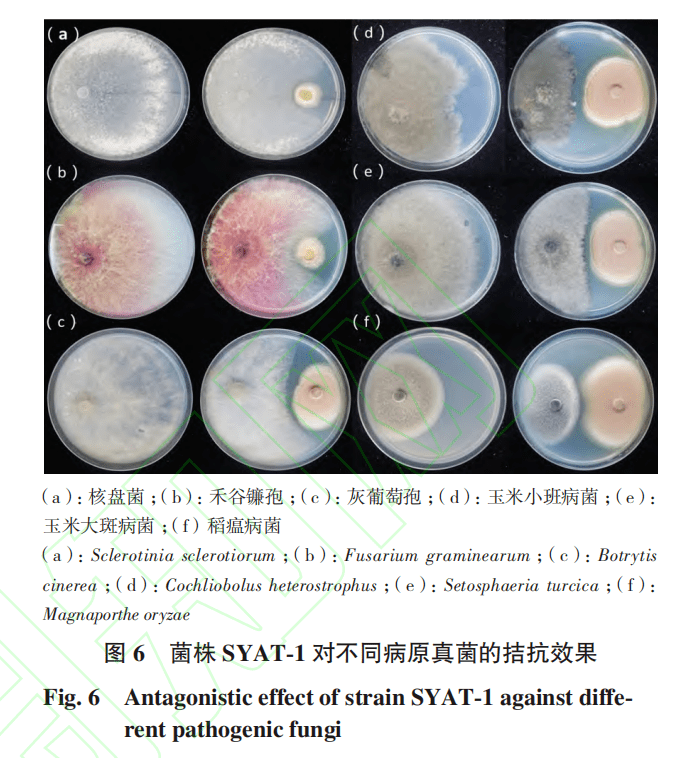 β-酮硫解酶缺乏症图片