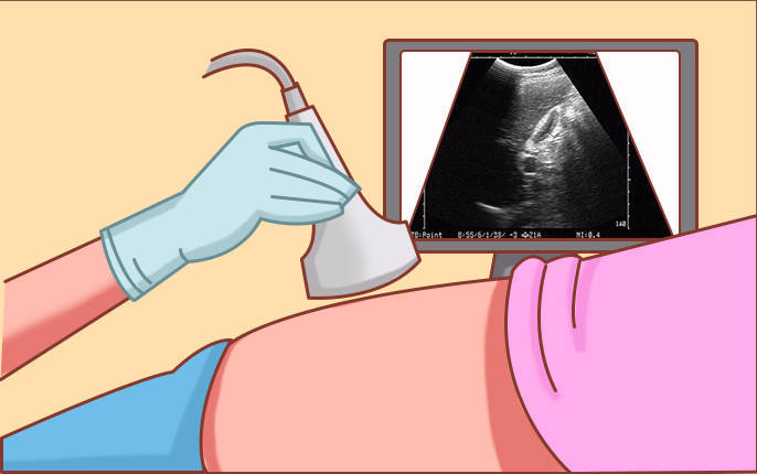 怀孕尿检单图片图片