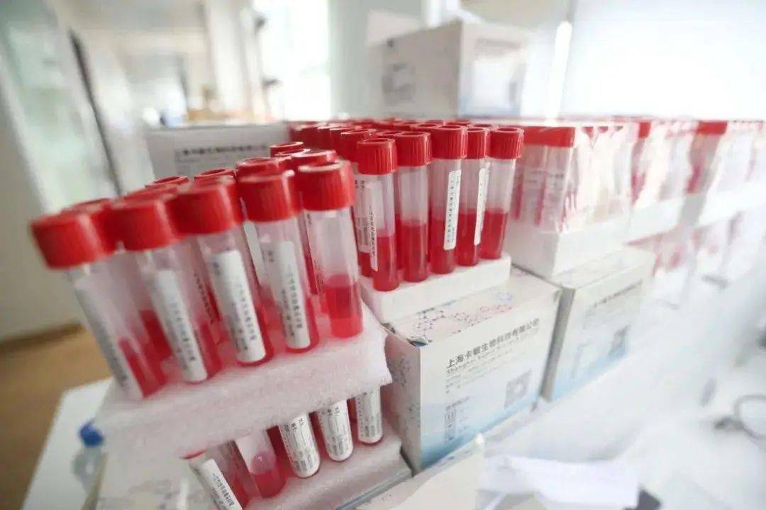 核酸采样管中的红色液体叫病毒核酸保存液.