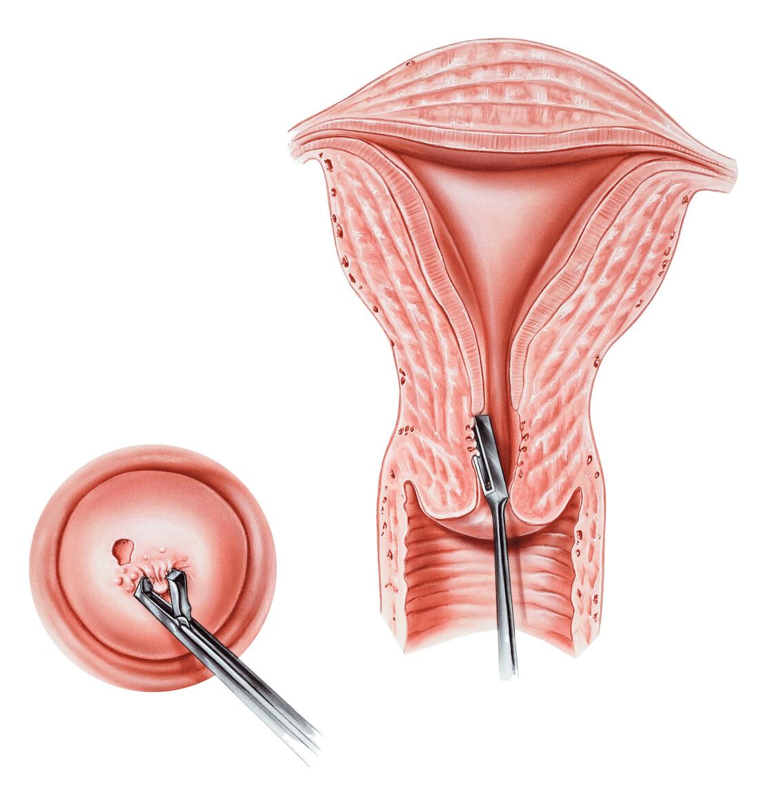 宫颈筛查正常报告单图图片