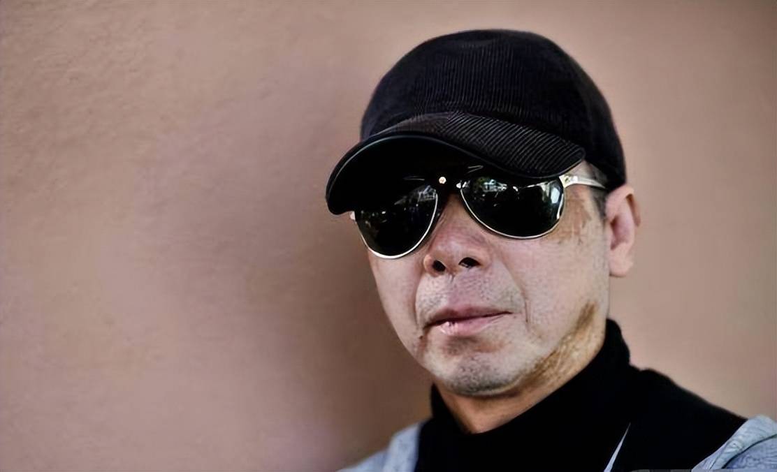 冯小刚—白癜风她自己的左边颚骨萎缩,上下颚牙齿不能咬合,所以说话时