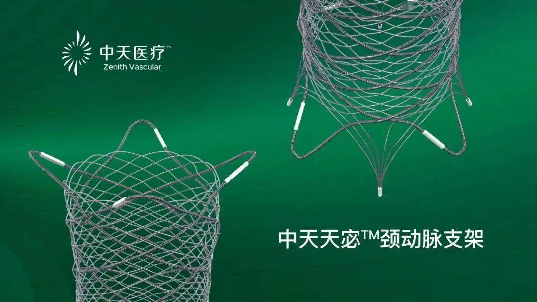 业界快讯丨中天天宓颈动脉支架临床试验正式启动_医疗_进行了_苏州