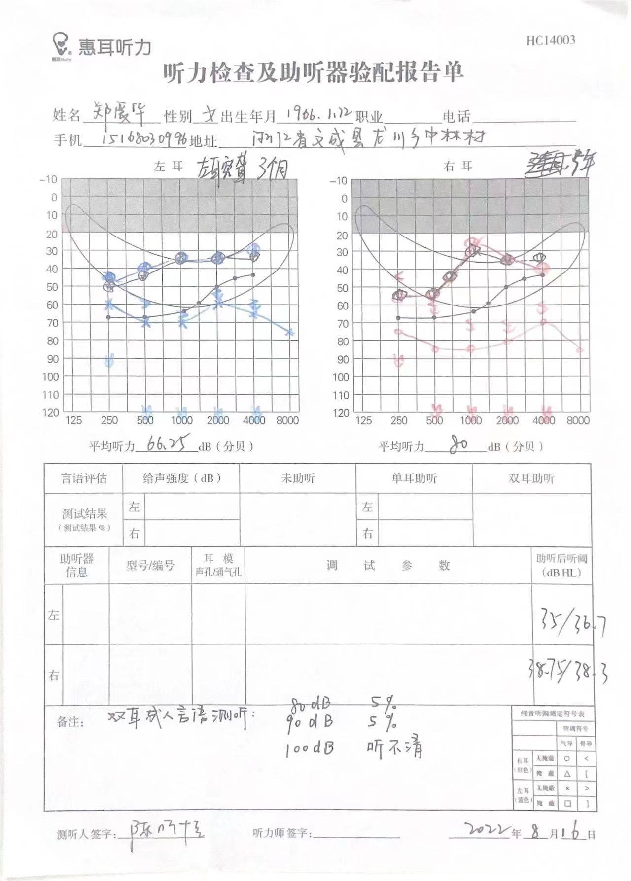 耳镜检查报告图片图片