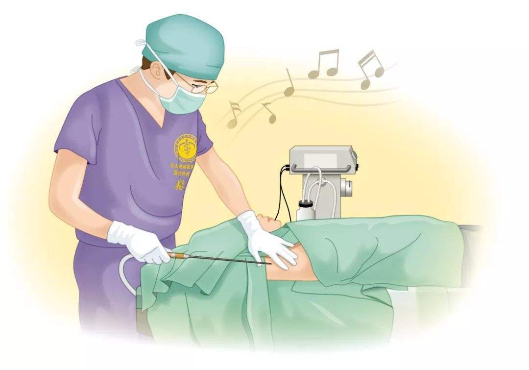 ③手术治疗安排!这个其实很简单直接,大汗腺你出汗对吧?