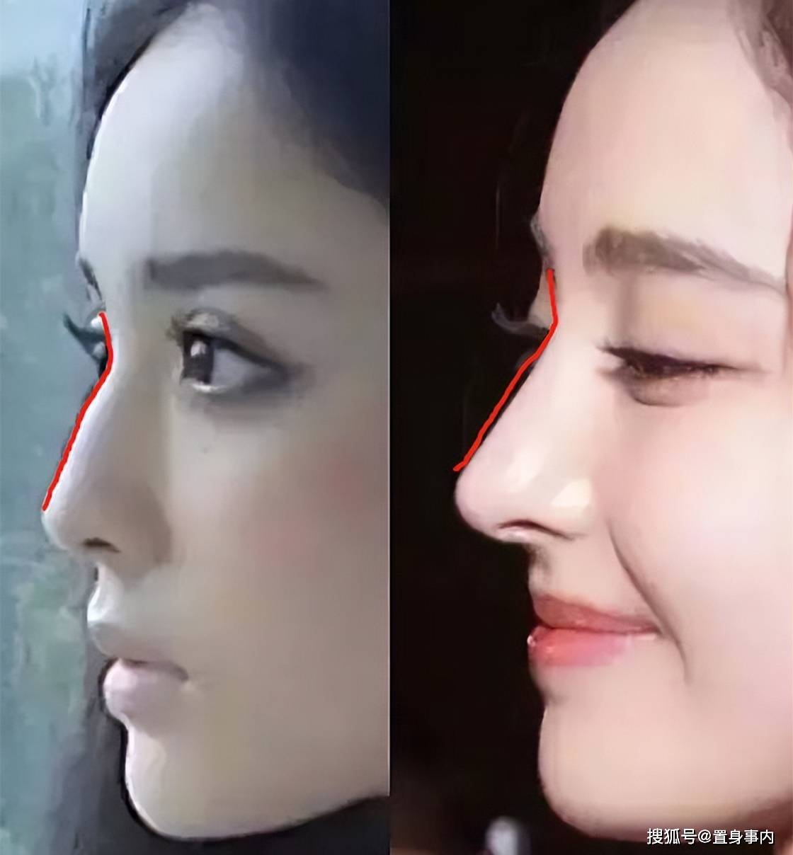 影视圈"假鼻子"大赏:谁堪称点睛之笔,谁"越整越残"?_杨紫_明星_气质