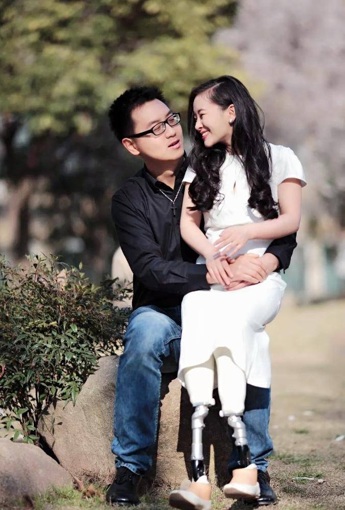 无腿舞者廖智:前任不管截肢她给出的理由奇葩,现任心里全是她_丈夫