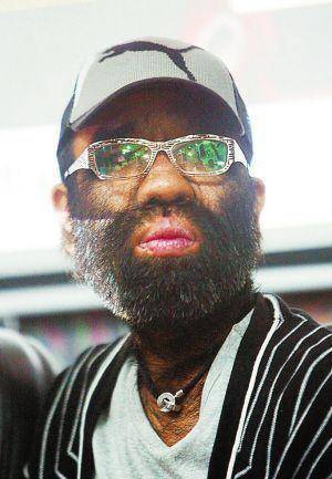 中国第一毛孩于震寰:42岁娶娇妻生下儿子,如今怎么样?_毛发_父亲_孩子