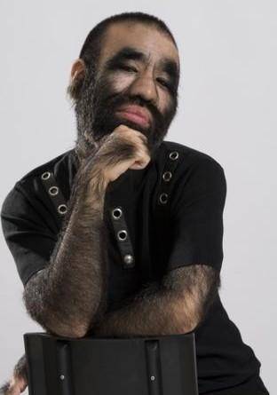 中国第一毛孩于震寰:42岁娶娇妻生下儿子,如今怎么样?_毛发_父亲_孩子