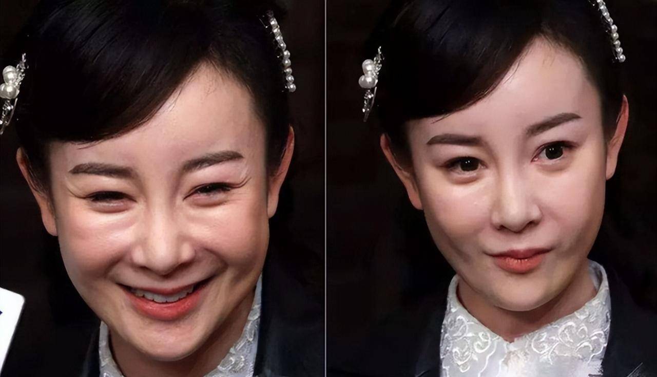脸皮耸拉,额头臃肿,表情僵硬,"整容"后的中年演员,都翻车了_蔡明