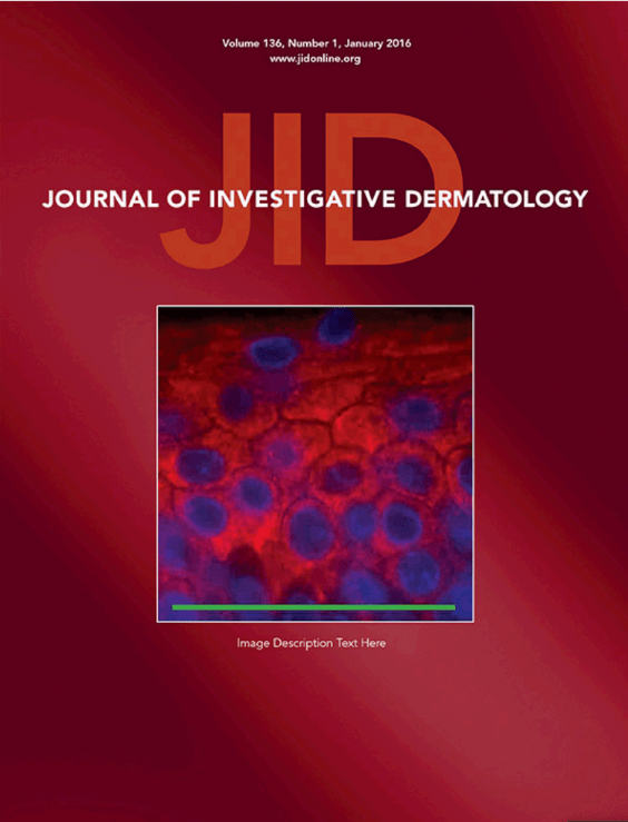 J Invest Dermatol | OAS家族在银屑病发病机制中的研究_论文_细胞_表皮