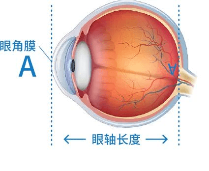 2022年最新发布：我国儿童眼轴长度标准_测量_管理_数据
