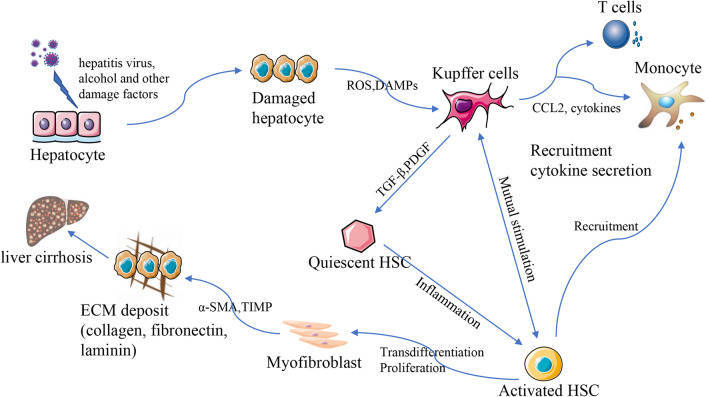 肝硬化机制图图片
