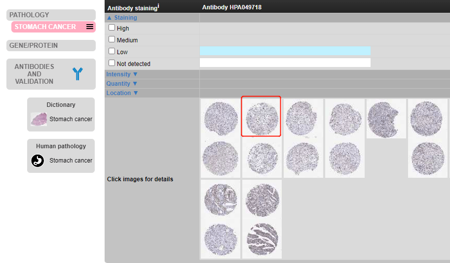 6+免疫热点趋化因子套路拆解！新鲜文献教你零代码复现_分析_Figure_数据