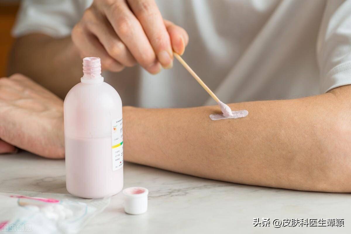 皮肤科医生和你聊聊:炉甘石洗剂可以治疗什么?有什么注意事项?