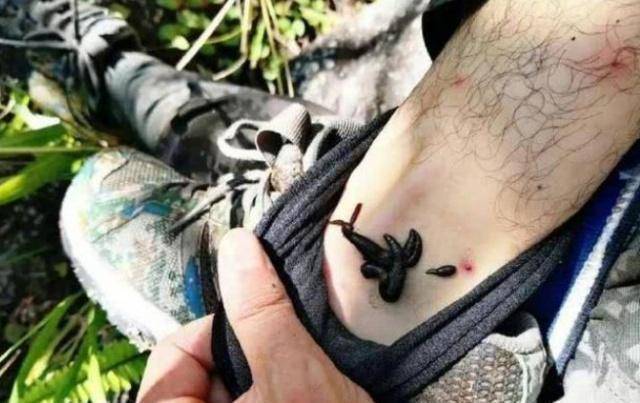 边防环境恶劣,士兵巡逻每次平均被50只蚂蟥吸血,没办