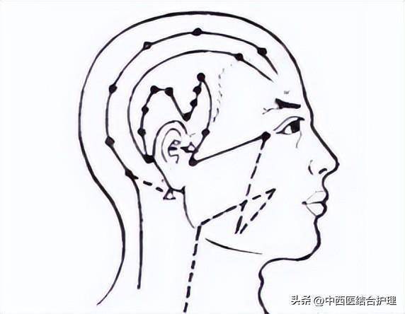 「穴位按摩养生」最齐全的穴位拍打