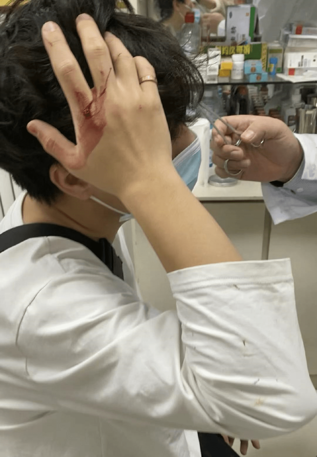 张兆艺家玻璃门意外炸裂,1岁女儿头部受伤,玻璃碎屑散落满地_老公